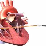 The Anatomy And Function Of The Tricuspid Valve In The Human Heart