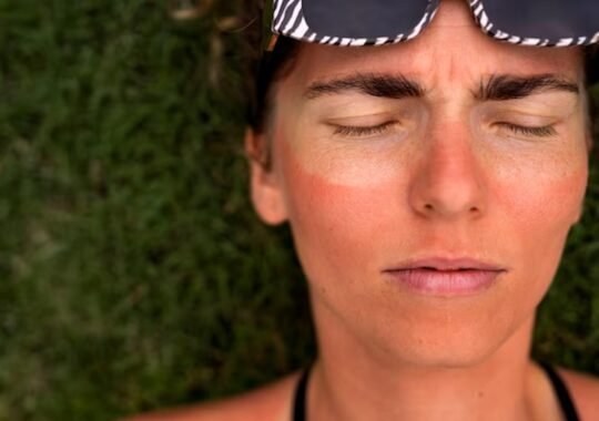 From Dull to Dazzling: Revitalizing Sun-Damaged Skin with the Power of Plasma