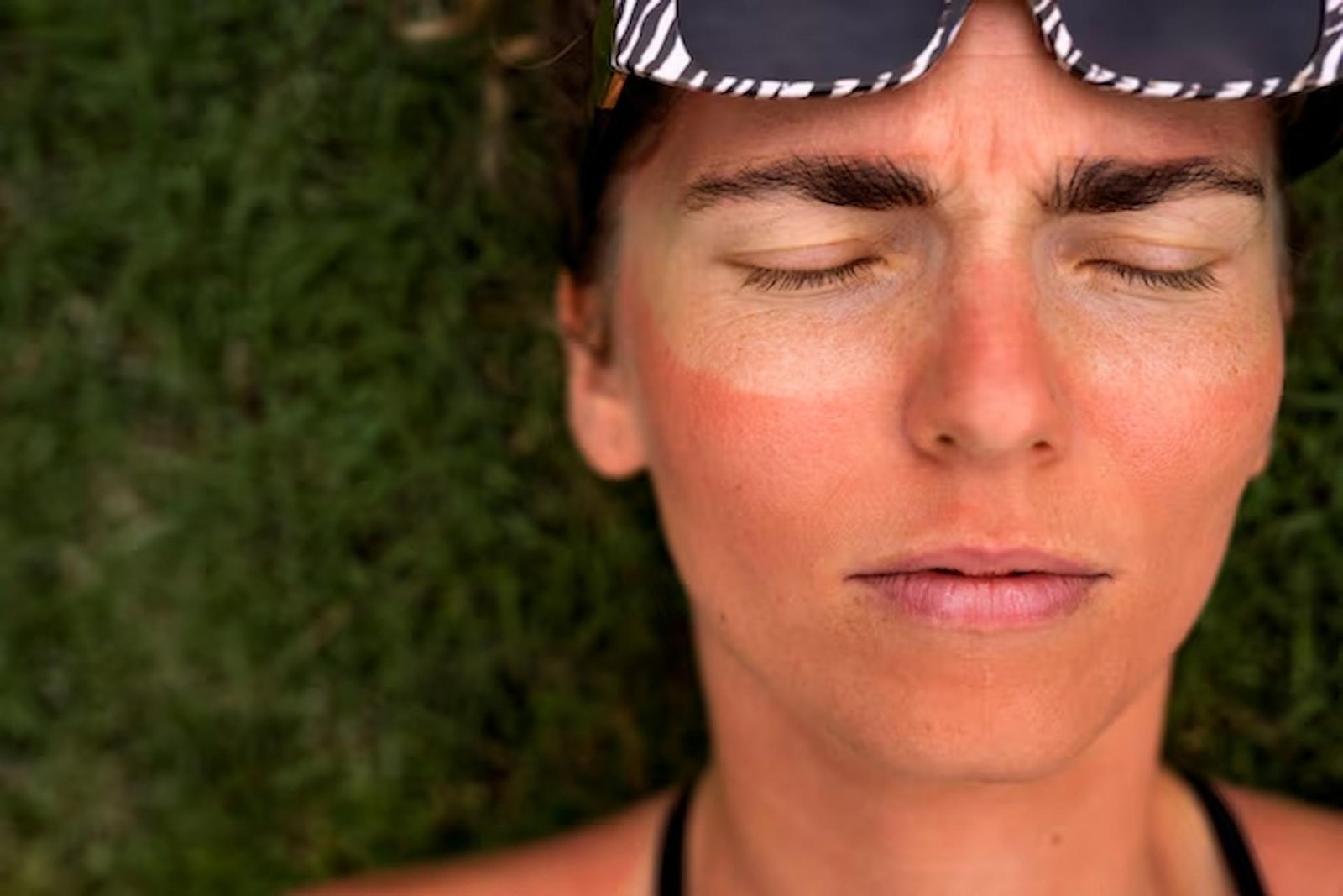 From Dull to Dazzling: Revitalizing Sun-Damaged Skin with the Power of Plasma