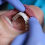Tips for Selecting Optimal Dental Reconstruction Options