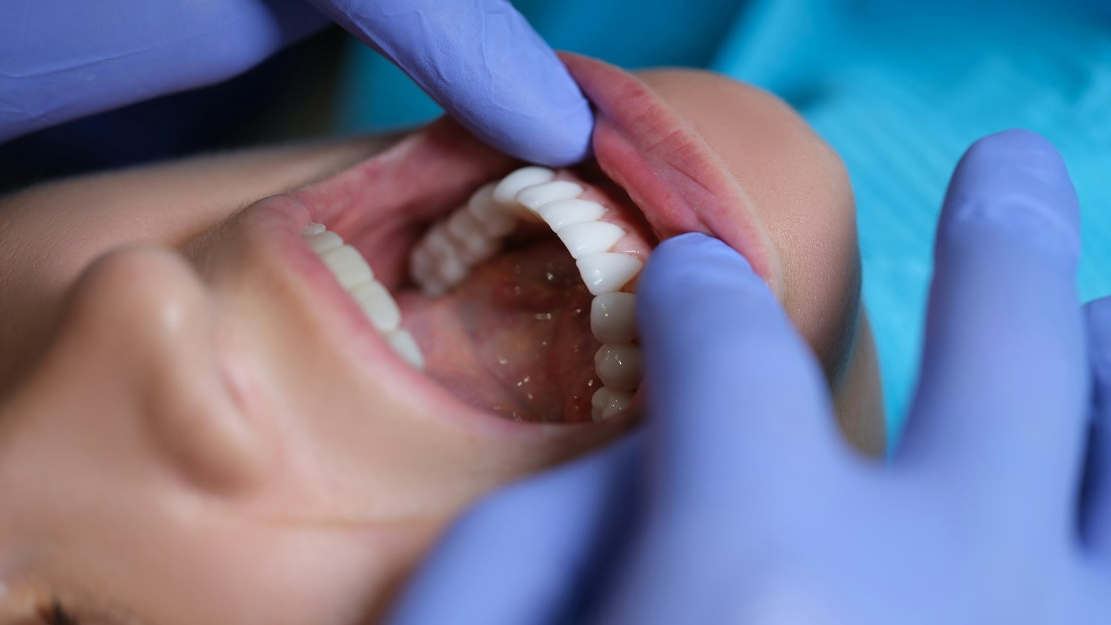 Tips for Selecting Optimal Dental Reconstruction Options