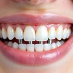 Investing in Your Oral Future: Key Insights into Why Today’s Dental Implants Offer Unparalleled Long-Term Value