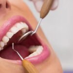 Why a Surrey Orthodontist Recommends Ceramic Dentures for a Natural Smile