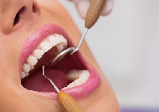 Why a Surrey Orthodontist Recommends Ceramic Dentures for a Natural Smile