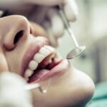 When Should You Choose Dental Bonding and Why Trust Falls Church’s Skilled Dentists