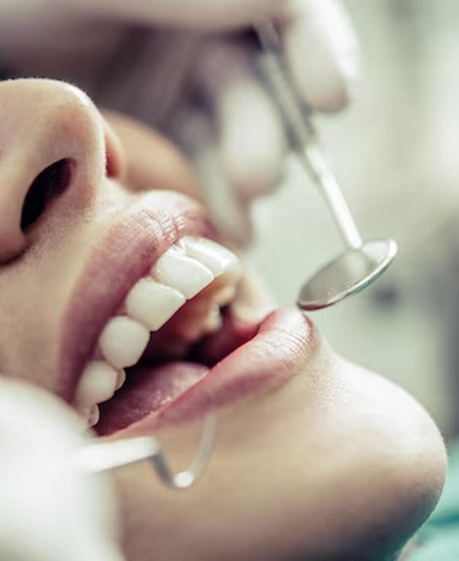When Should You Choose Dental Bonding and Why Trust Falls Church’s Skilled Dentists
