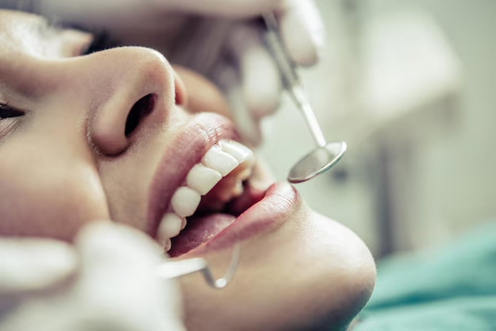 When Should You Choose Dental Bonding and Why Trust Falls Church’s Skilled Dentists