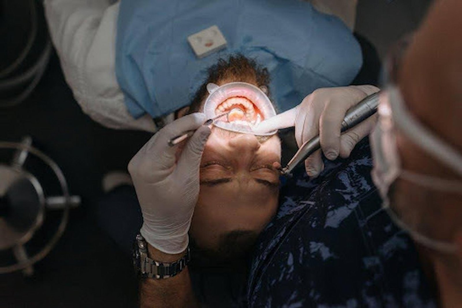 Understanding the Signs You Might Need Wisdom Teeth Removal