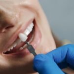 How Dental Implants Change Smiles for a Lifetime