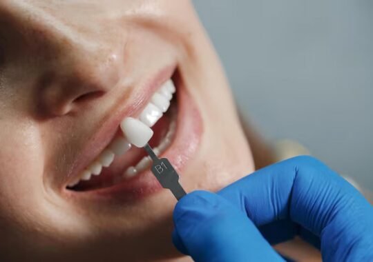 How Dental Implants Change Smiles for a Lifetime