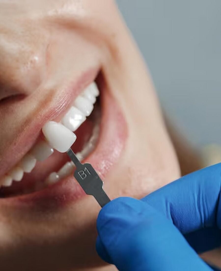 How Dental Implants Change Smiles for a Lifetime