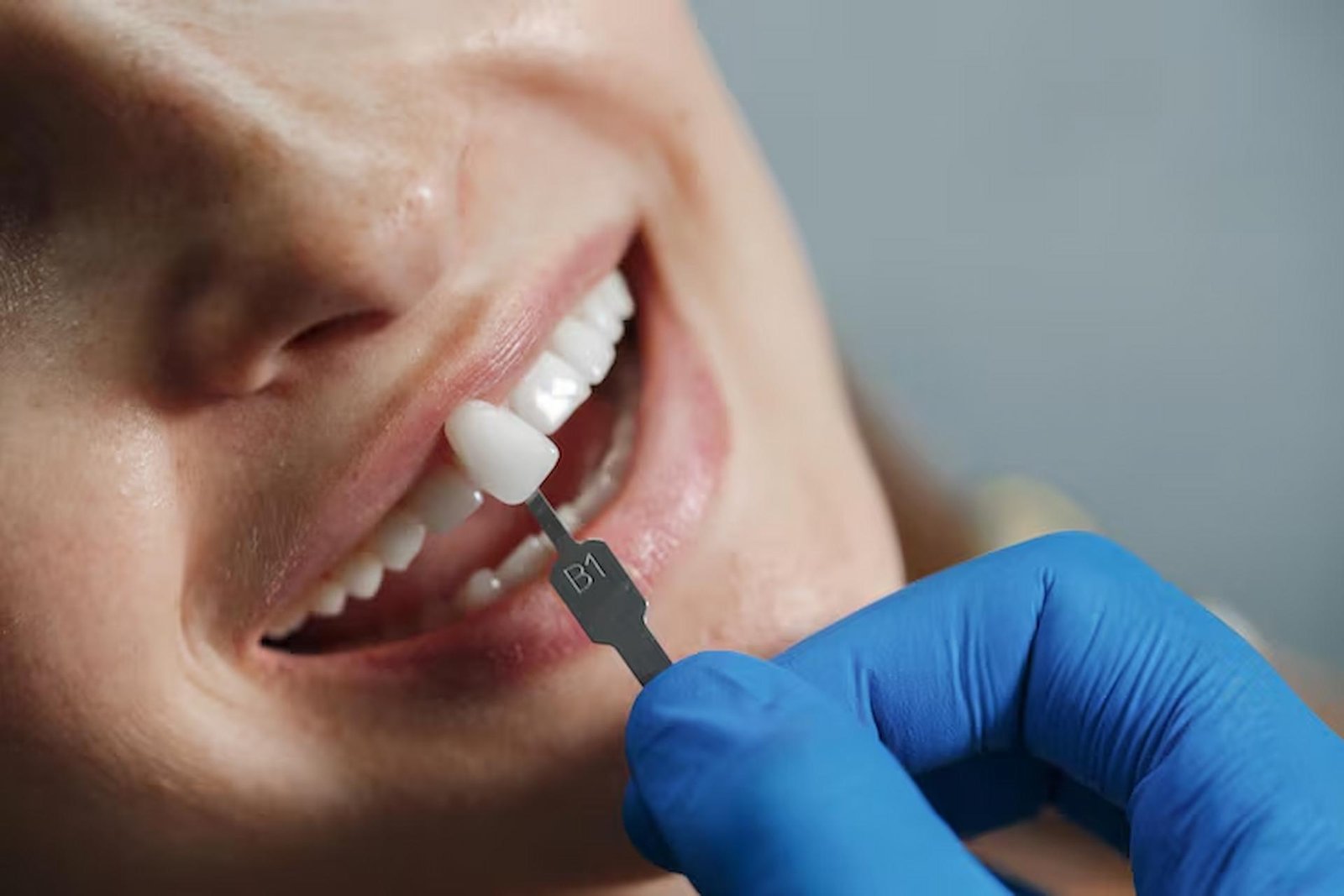 How Dental Implants Change Smiles for a Lifetime