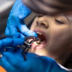 How Pediatric Dentists in Overland Park Treat Cavities Hidden Between Two Touching Molars