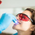 What Professional Teeth Whitening Removes That Toothpaste Cannot in Edison