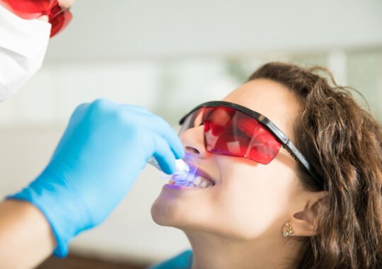 What Professional Teeth Whitening Removes That Toothpaste Cannot in Edison