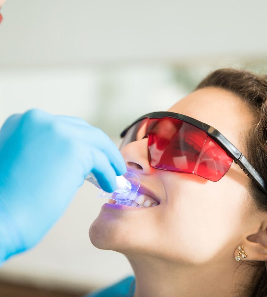What Professional Teeth Whitening Removes That Toothpaste Cannot in Edison